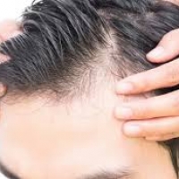 Avere i capelli in poche ore? La tricopigmentazione