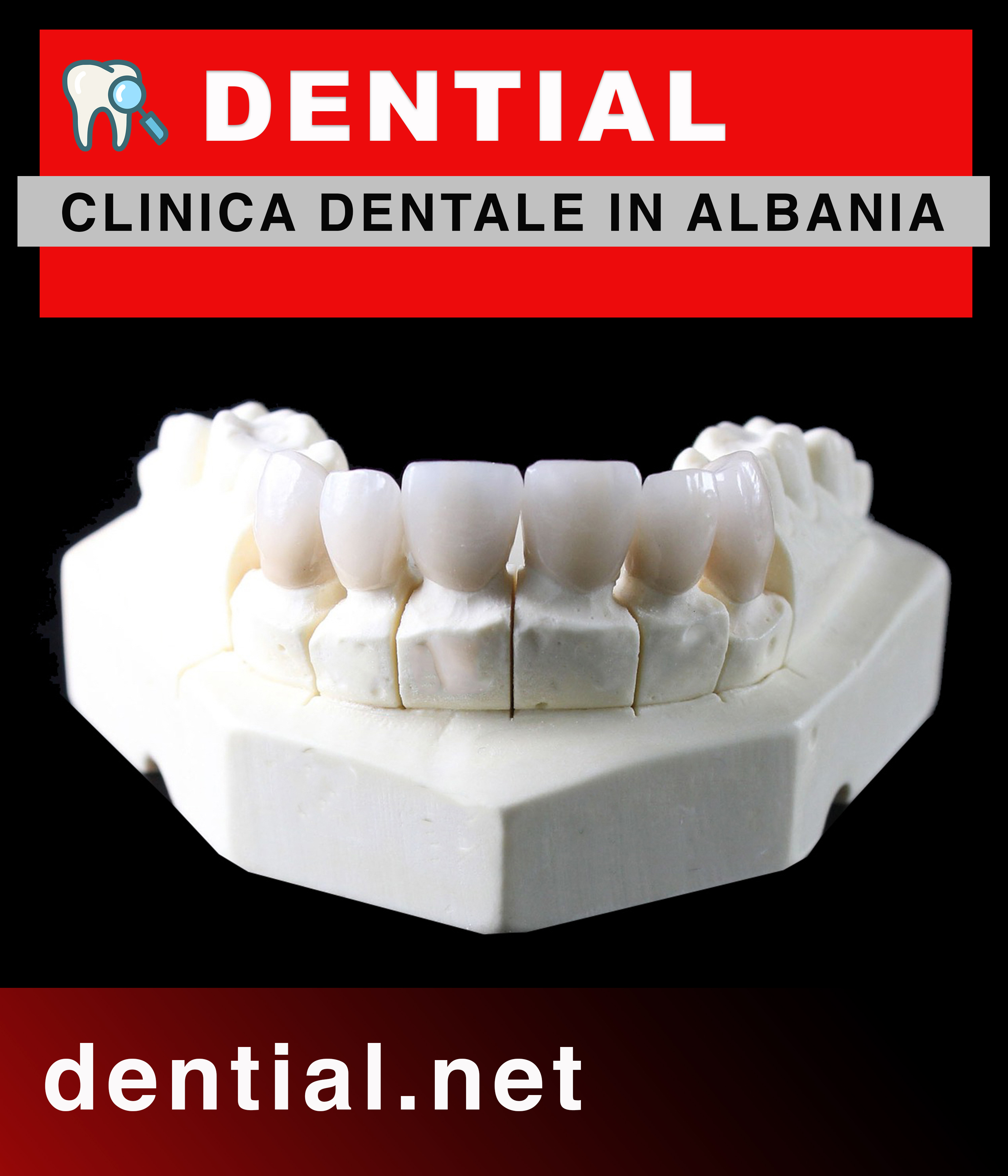 Corone dentali in Albania e capsule per i denti in porcellana a Durazzo