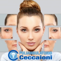 Botox e Filler a Frascati Poliambulatorio Ceccaioni