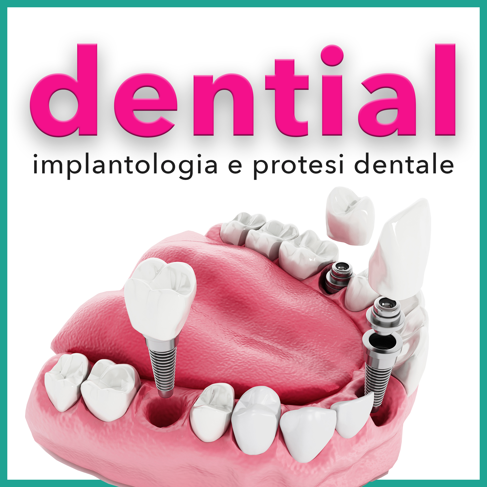 Dentisti Albania opinioni degli italiani sulle cliniche dentali a Durazzo e Tirana