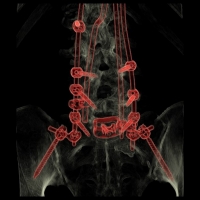 L’algoritmo che migliora la Radiodiagnostica