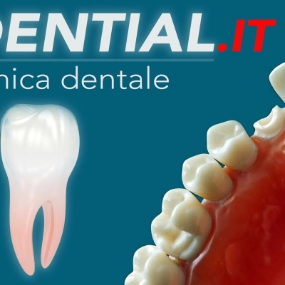 Impianti dentali all’estero: come scegliere le migliori cure odontoiatriche in Albania