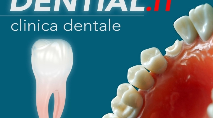 Impianti dentali all’estero: come scegliere le migliori cure odontoiatriche in Albania