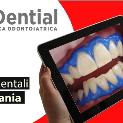 Impianti dentali in Albania