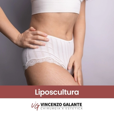 Liposcultura Roma Dott. Vincenzo Galante