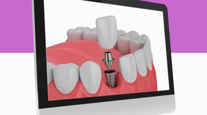 Meglio dentisti in Croazia o Albania?