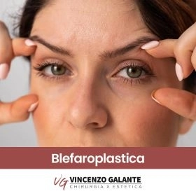 Chirurgo Dott. Vincenzo Galante: esperto in blefaroplastica per un nuovo sguardo