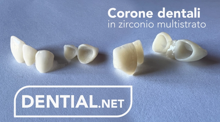 Cure dentali in Croazia oppure nella più vantaggiosa Albania?