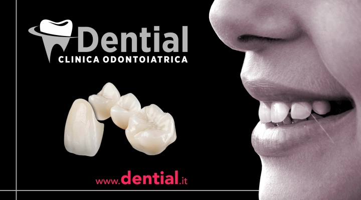 Corone dentali in Albania con zirconio Made in Giappone