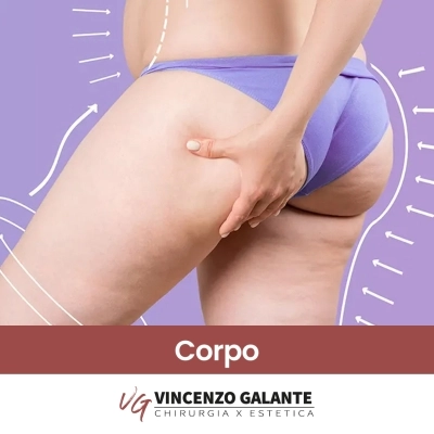 Rimodellamento Corpo Liposcultura a Roma Dott. Vincenzo Galante