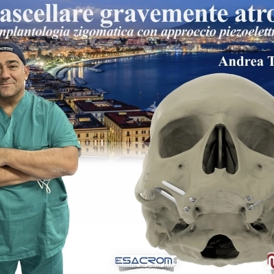 Richieste da tutto il mondo del CORSO ZYGOMA E LIVE SURGERY DEL DOTTOR TEDESCO