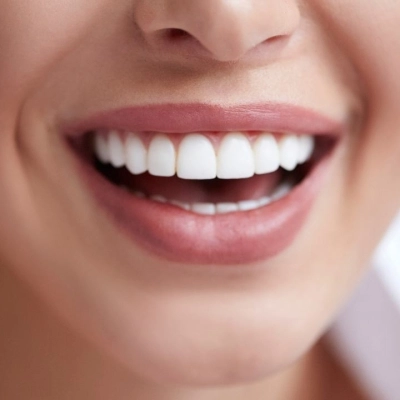 Le Funzioni dei Denti: Importanza nella Masticazione, nella Parola e nell'Estetica del Sorriso