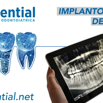 Clinica Dential a Durazzo, centro specializzato in cure dentali in Albania