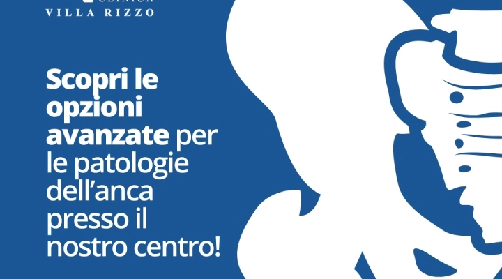 Protesi Anca a Siracusa Clinica Villa Rizzo: Osteotomie Correttive e Artroprotesi Totali