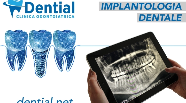 Clinica Dential a Durazzo, centro specializzato in cure dentali in Albania