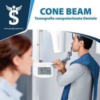 Cone Beam | dose di radiazioni bassa, esame rapido e sicuro | Poliambulatorio Sanem