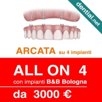 Clinica dentale a Durazzo, Dential il centro dentistico di riferimento per gli italiani all'estero
