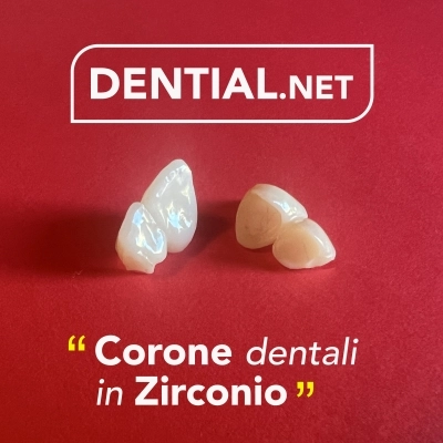 Corone dentali e faccette estetiche dai dentisti in Albania