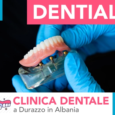 impianti dentali in Albania, informazioni, dentisti e prezzi