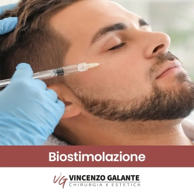 Biostimolazione trattamenti estetici non invasivi Dott. Vincenzo Galante a Roma