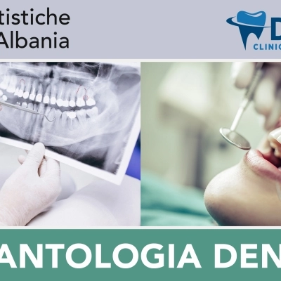I dentisti in Albania e le cliniche odontoiatriche di Durazzo per la cura dei denti di pazienti italiani