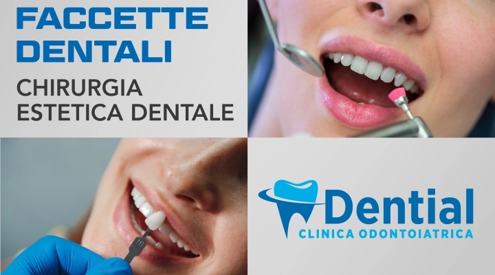 Eliminare i difetti estetici dei denti con la clinica DENTIAL 